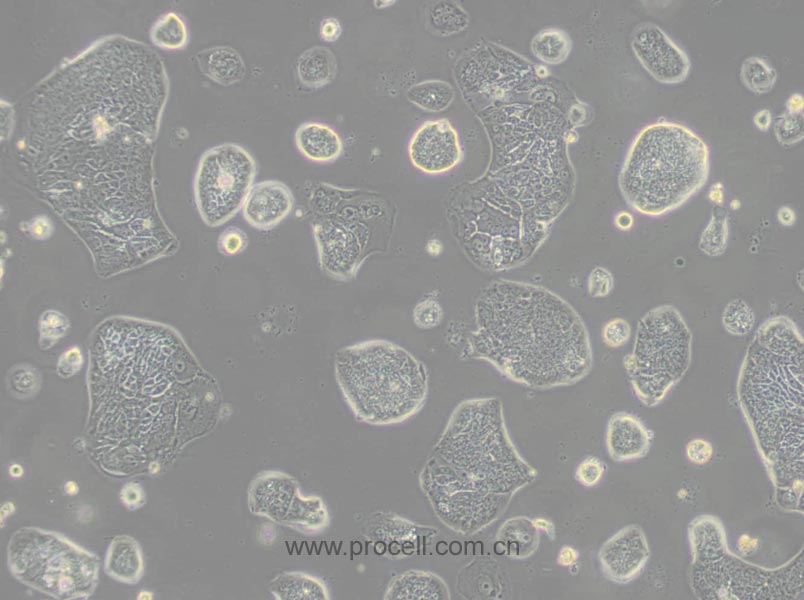 SW1116 (人结肠腺癌细胞) (STR鉴定正确)