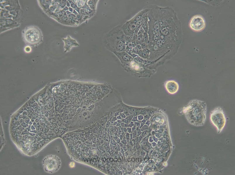 SW1116 (人结肠腺癌细胞) (STR鉴定正确)