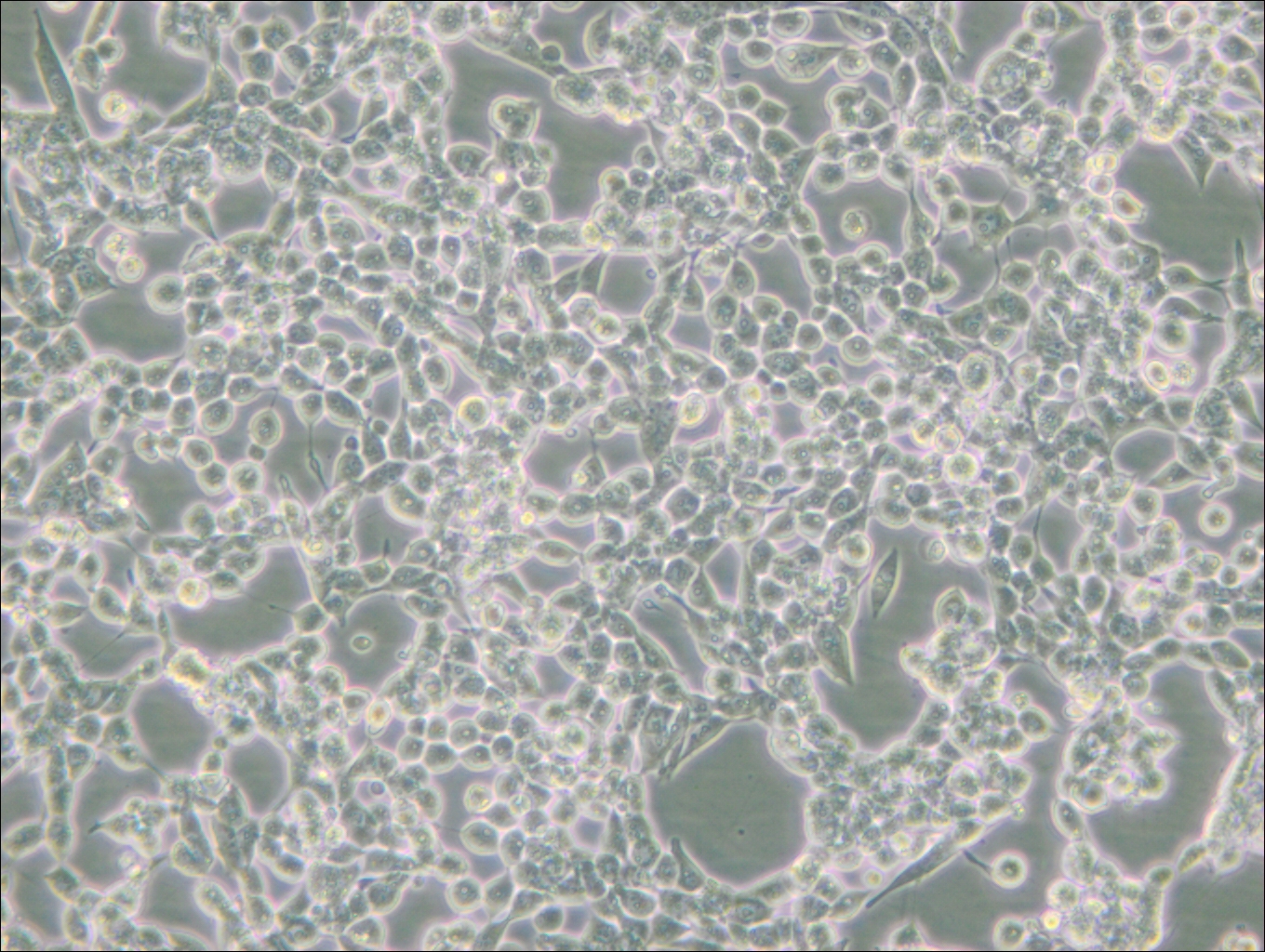 293E (人胚肾细胞(EBNA1基因修饰))(STR鉴定正确)