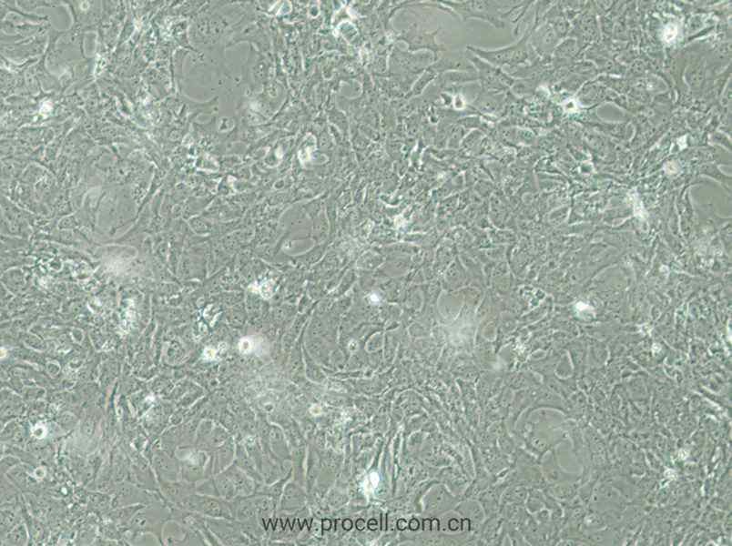 HCC38 (人乳腺导管癌细胞) (STR鉴定正确)