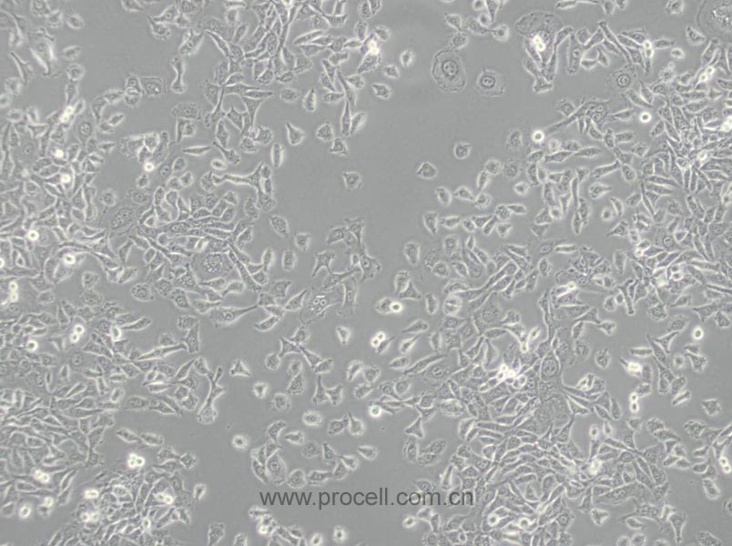 MDA-MB-415 (人乳腺癌细胞) (STR鉴定正确)