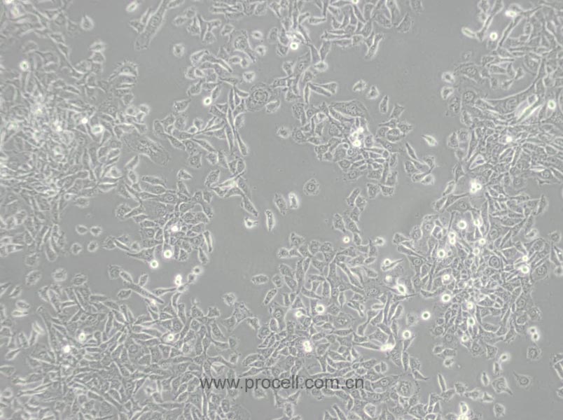 MDA-MB-415 (人乳腺癌细胞) (STR鉴定正确)