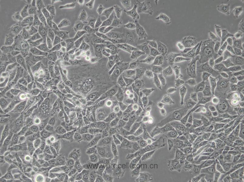 MDA-MB-415 (人乳腺癌细胞) (STR鉴定正确)