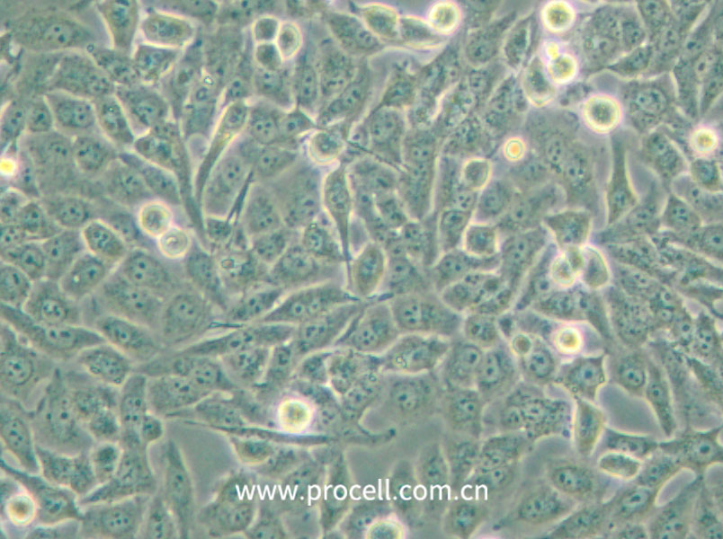 NCI-H157 (人非小细胞肺腺癌细胞) (STR鉴定正确)