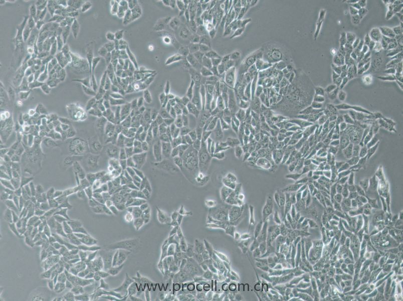 NCI-H358 (人非小细胞肺癌细胞) (STR鉴定正确)