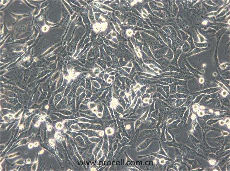 NCI-H596 (人肺腺鳞癌细胞) (STR鉴定正确）