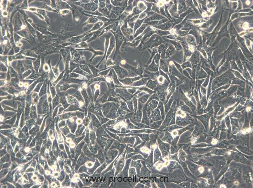 NCI-H596 (人肺腺鳞癌细胞) (STR鉴定正确）