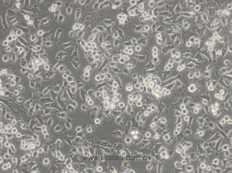 NCTC 1469 (小鼠正常肝细胞) (STR鉴定正确)