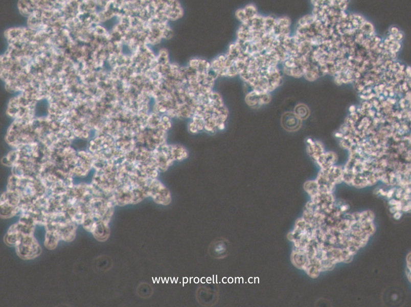 PC-12(Undifferentiated) (大鼠肾上腺嗜铬细胞瘤细胞(未分化)) (种属鉴定正确)