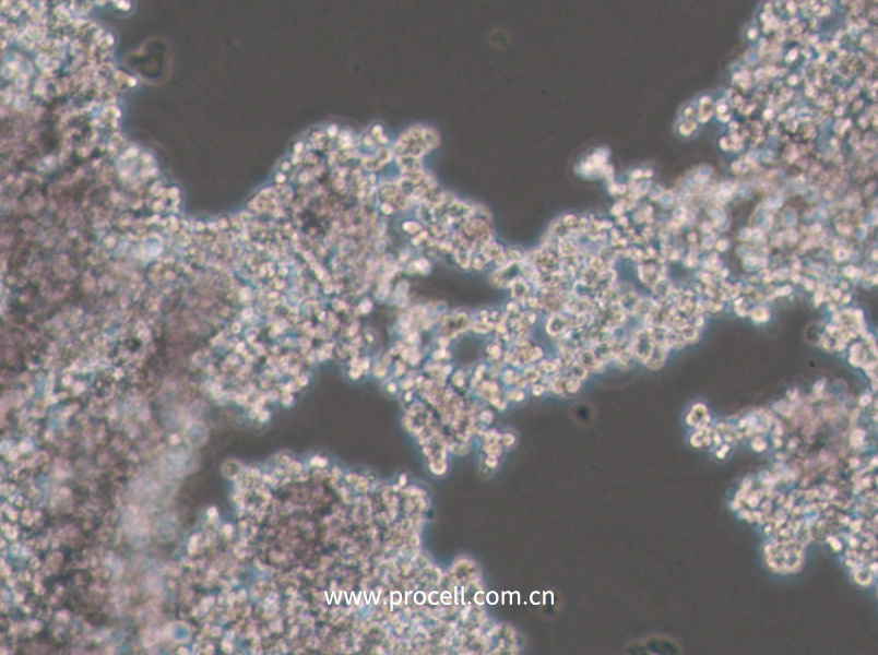 PC-12(Undifferentiated) (大鼠肾上腺嗜铬细胞瘤细胞(未分化)) (种属鉴定正确)