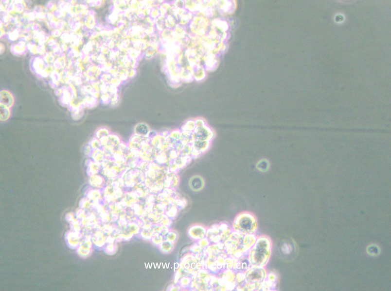 PC-12(Undifferentiated) (大鼠肾上腺嗜铬细胞瘤细胞(未分化)) (种属鉴定正确)