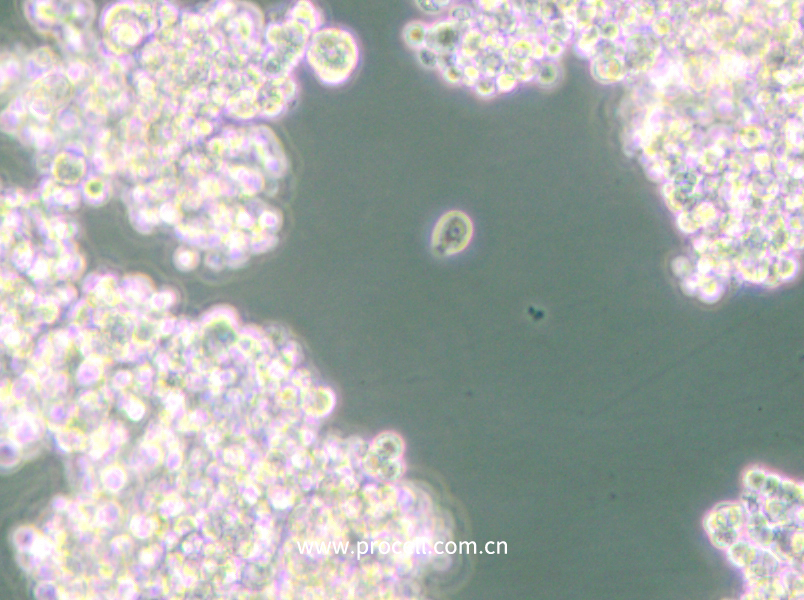 PC-12(Undifferentiated) (大鼠肾上腺嗜铬细胞瘤细胞(未分化)) (种属鉴定正确)