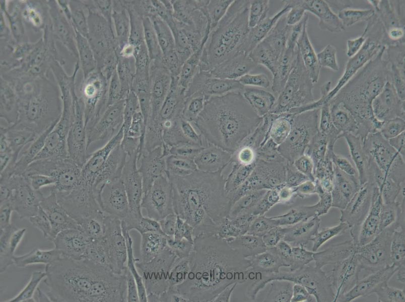 SW 1353 (人软骨肉瘤细胞) (STR鉴定正确)