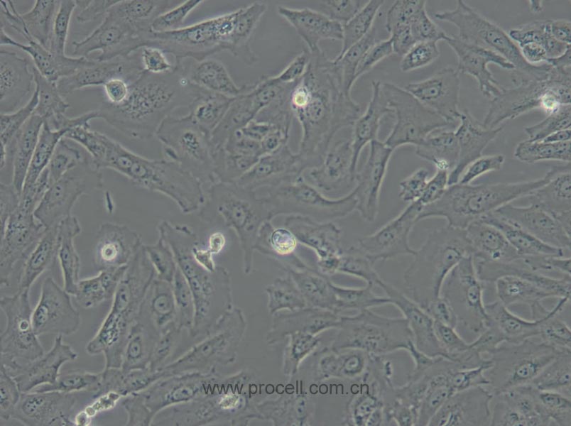 SW 1353 (人软骨肉瘤细胞) (STR鉴定正确)