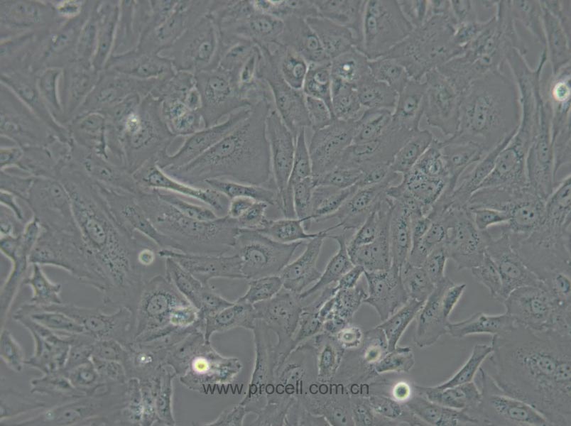 SW 1353 (人软骨肉瘤细胞) (STR鉴定正确)