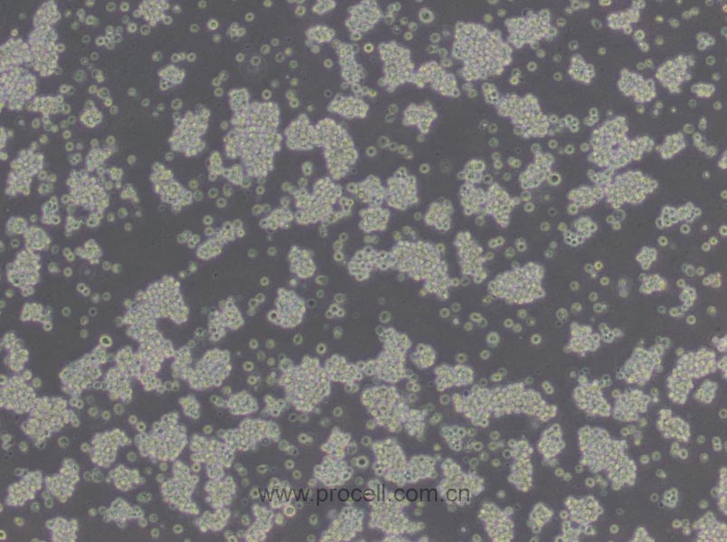 L5178Y TK+/- clone(3.7.2C) (小鼠淋巴瘤细胞) (STR鉴定正确)