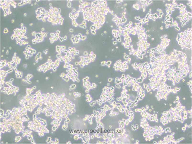 WERI-Rb-1 (人视网膜神经胶质瘤细胞) (STR鉴定正确)