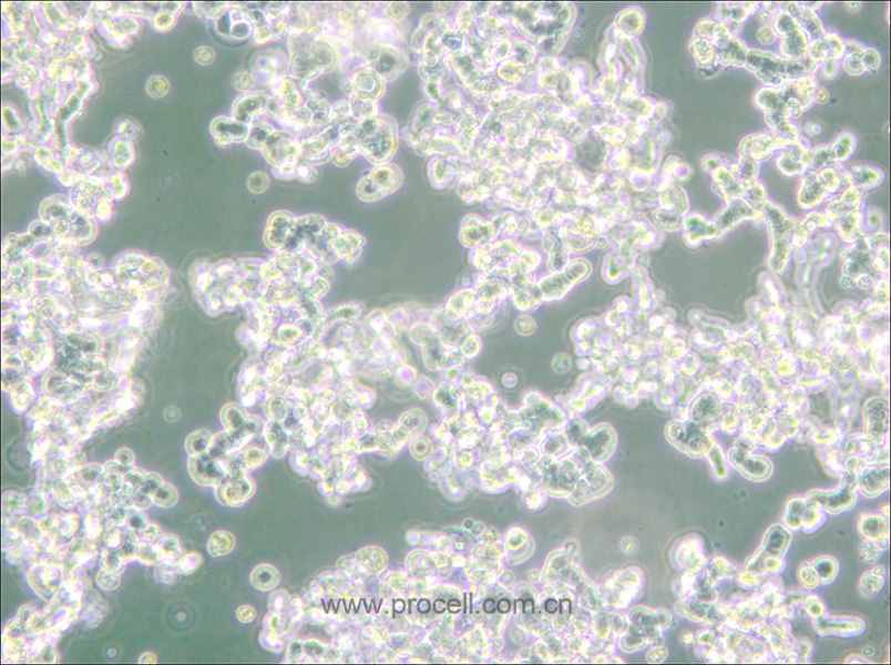 WERI-Rb-1 (人视网膜神经胶质瘤细胞) (STR鉴定正确)