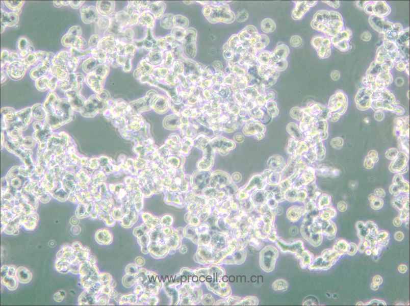 WERI-Rb-1 (人视网膜神经胶质瘤细胞) (STR鉴定正确)