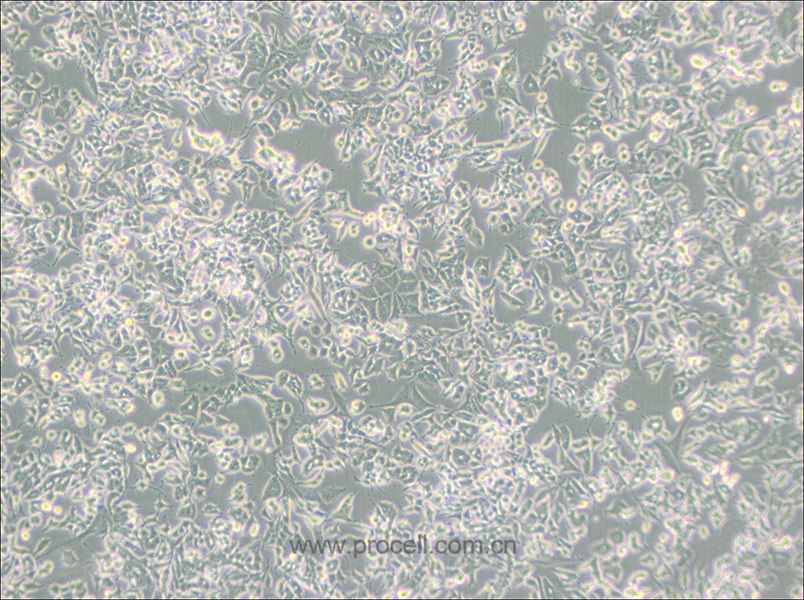 PC-12(Low differentiation) (大鼠肾上腺嗜铬细胞瘤细胞(低分化)) (种属鉴定正确)