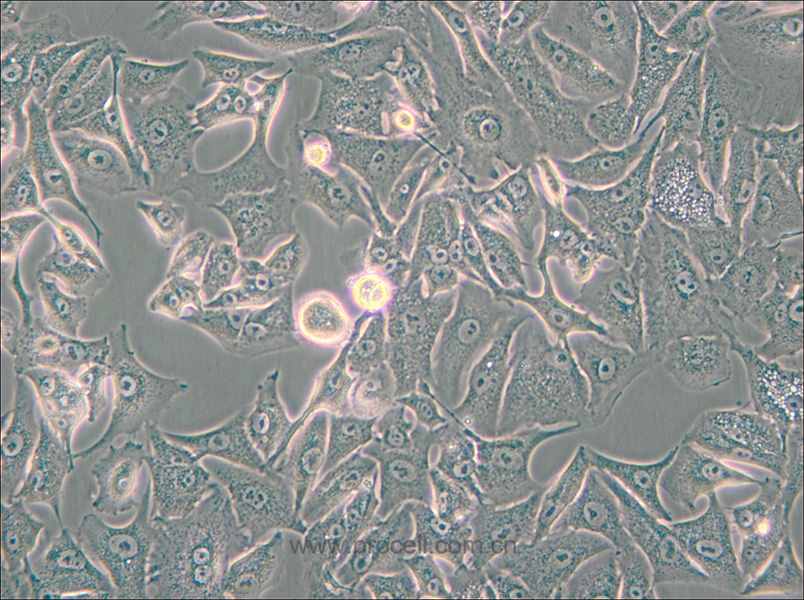 A549/DDP (人肺腺癌耐顺铂株)(STR鉴定正确)