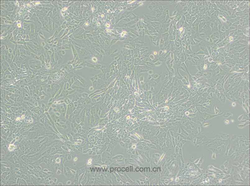 MCF 10A (人正常乳腺上皮细胞) (STR鉴定正确)