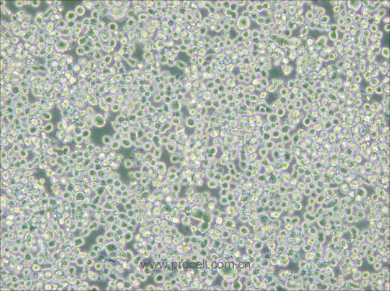 RPMI 8226 (人多发性骨髓瘤外周血B淋巴细胞) (STR鉴定正确)