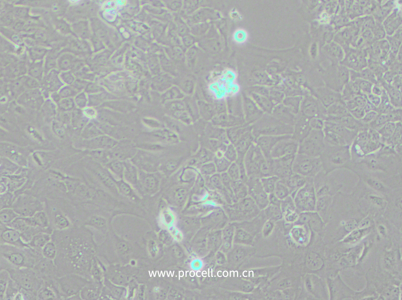 SCC-9 [SCC 9; SCC9] (人舌鳞癌细胞) (STR鉴定正确)