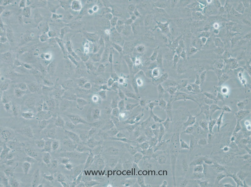 HMEC-1 (人微血管内皮细胞) (STR鉴定正确)