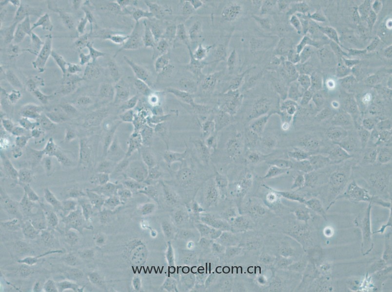 HMEC-1 (人微血管内皮细胞) (STR鉴定正确)