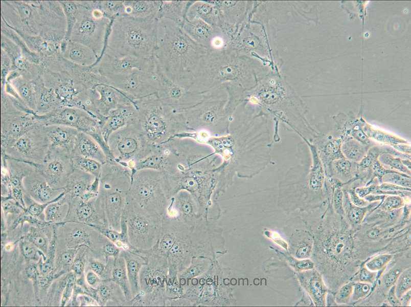 NCI-H2347 (人肺癌细胞) (STR鉴定正确)