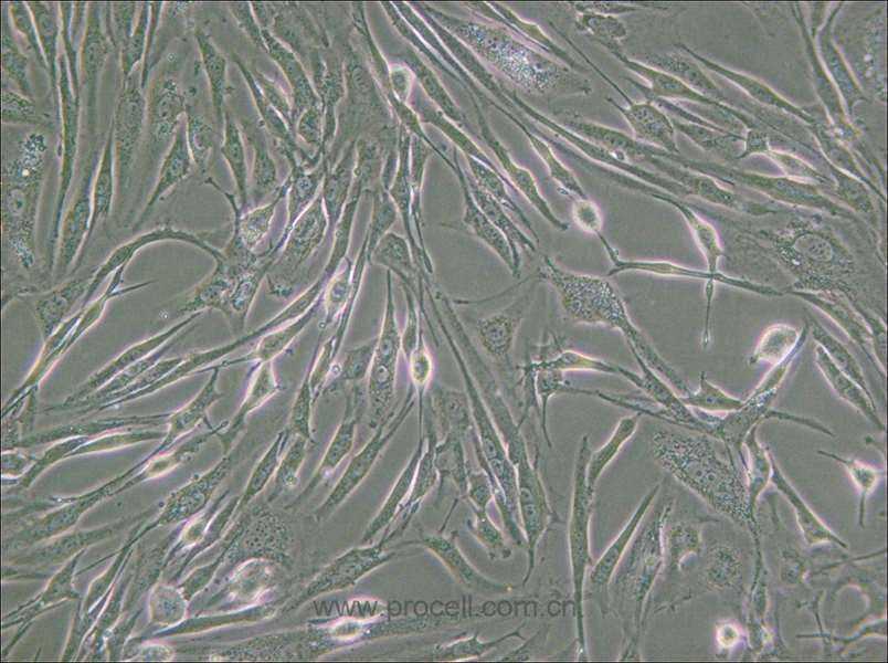 8305C (人甲状腺癌细胞(未分化)) (STR鉴定正确)