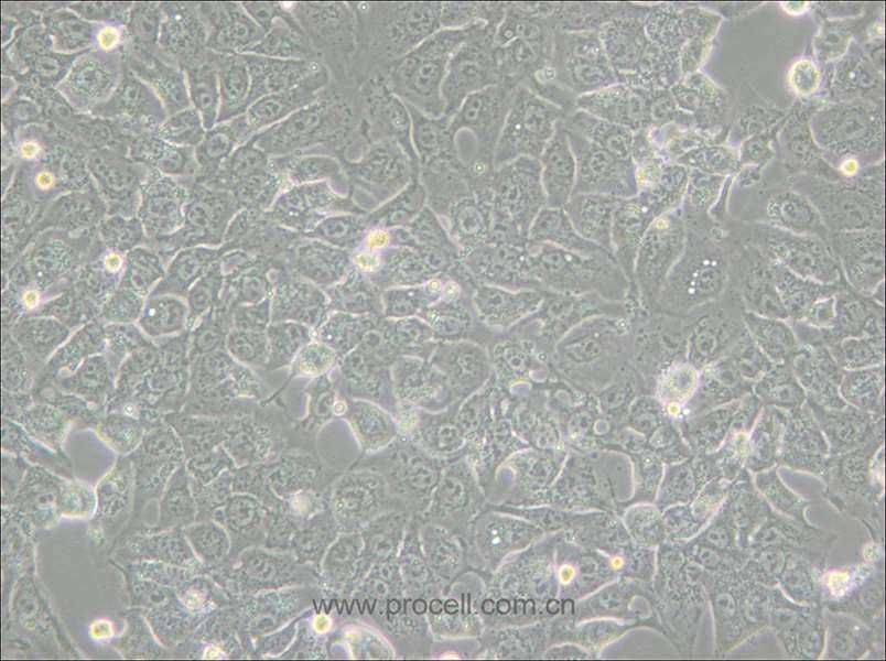 BHT101 (人甲状腺癌细胞(未分化)) (STR鉴定正确)