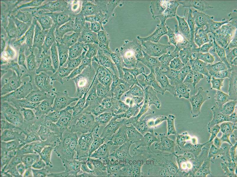 KHM-5M (人甲状腺癌细胞(未分化)) (STR鉴定正确)