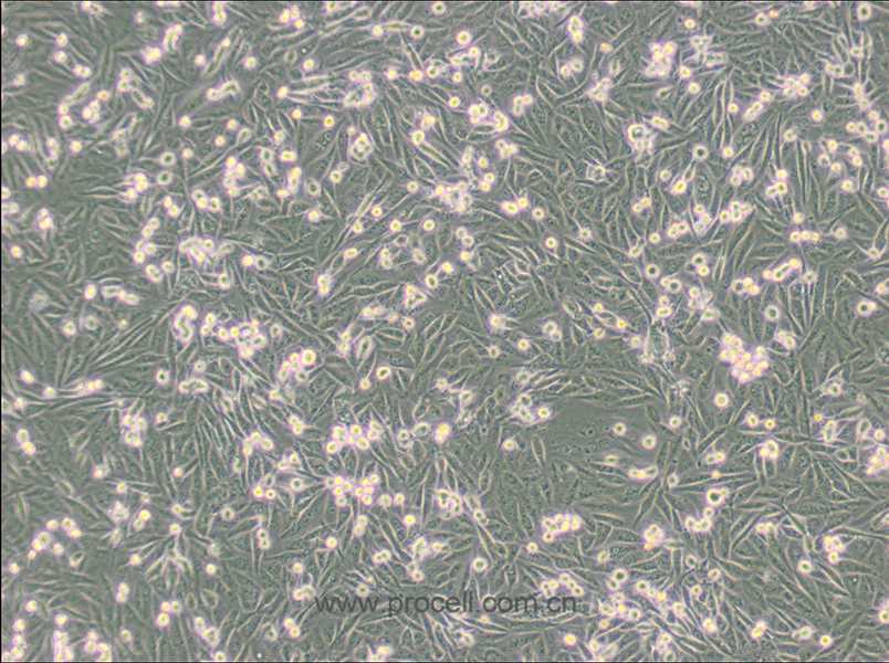 MDA-MB-231/GFP (人乳腺癌细胞(绿色荧光蛋白标记) (STR鉴定正确)