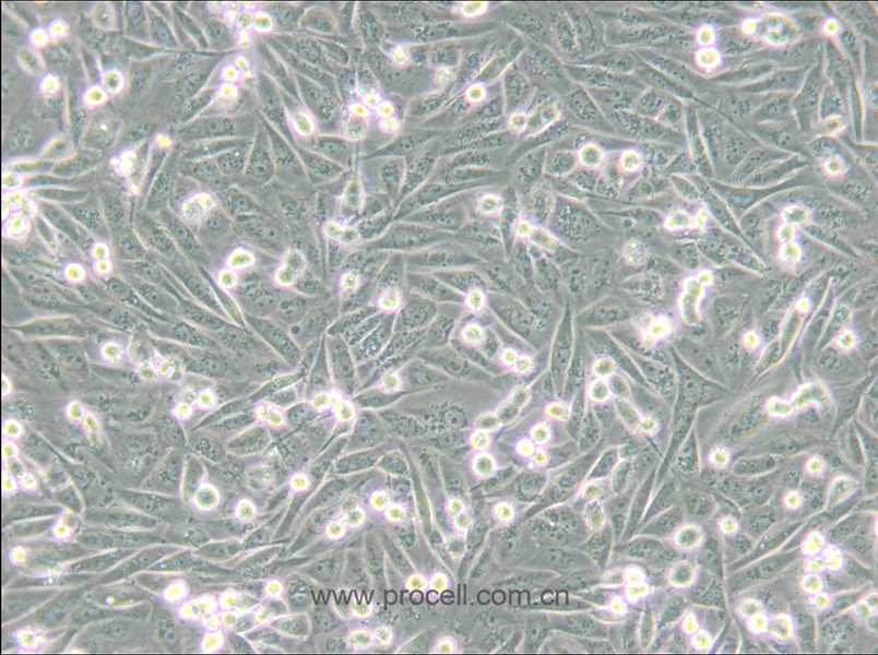 MDA-MB-231/GFP (人乳腺癌细胞(绿色荧光蛋白标记) (STR鉴定正确)