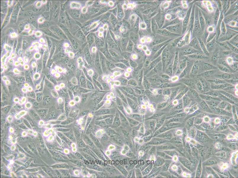 MDA-MB-231/GFP (人乳腺癌细胞(绿色荧光蛋白标记) (STR鉴定正确)