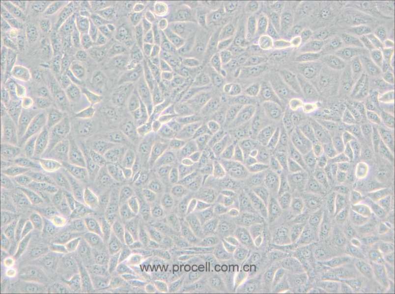 TPC-1 (人甲状腺癌细胞) (STR鉴定正确)