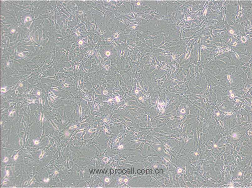 MET-5A (人间皮细胞) (STR鉴定正确)