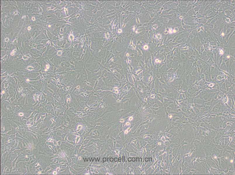 MET-5A (人间皮细胞) (STR鉴定正确)