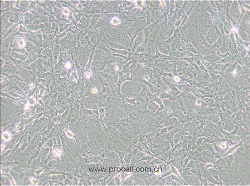 MET-5A (人间皮细胞) (STR鉴定正确)