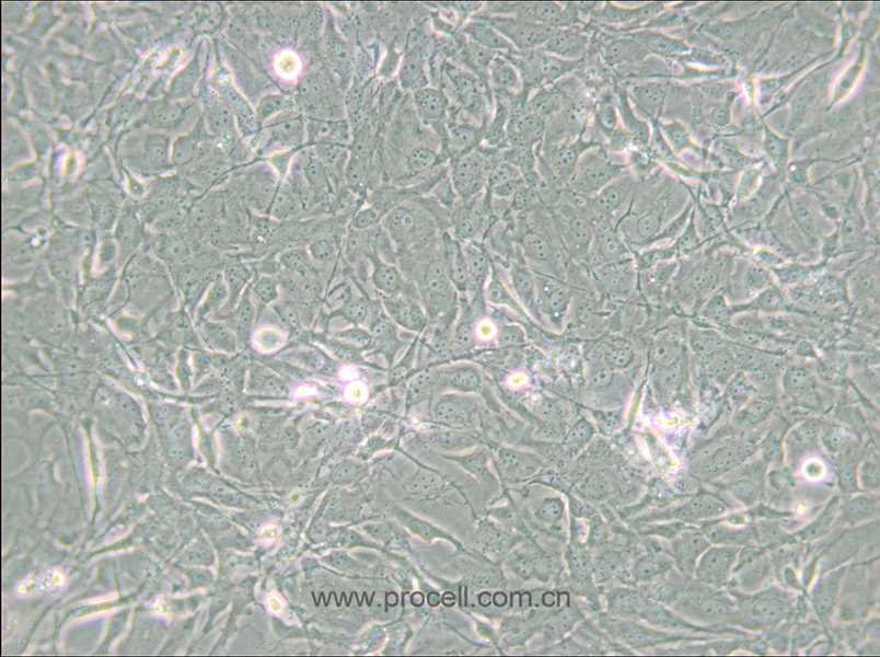 MET-5A (人间皮细胞) (STR鉴定正确)