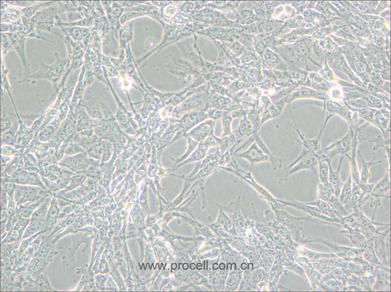 Hey (人卵巢癌细胞) (STR鉴定正确)