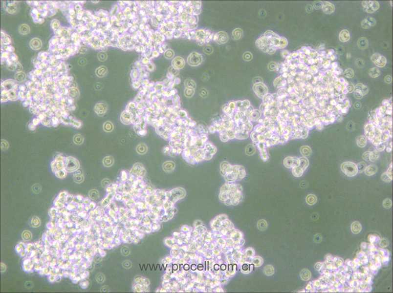 NCI-H69 (人小细胞肺癌细胞) (STR鉴定正确)