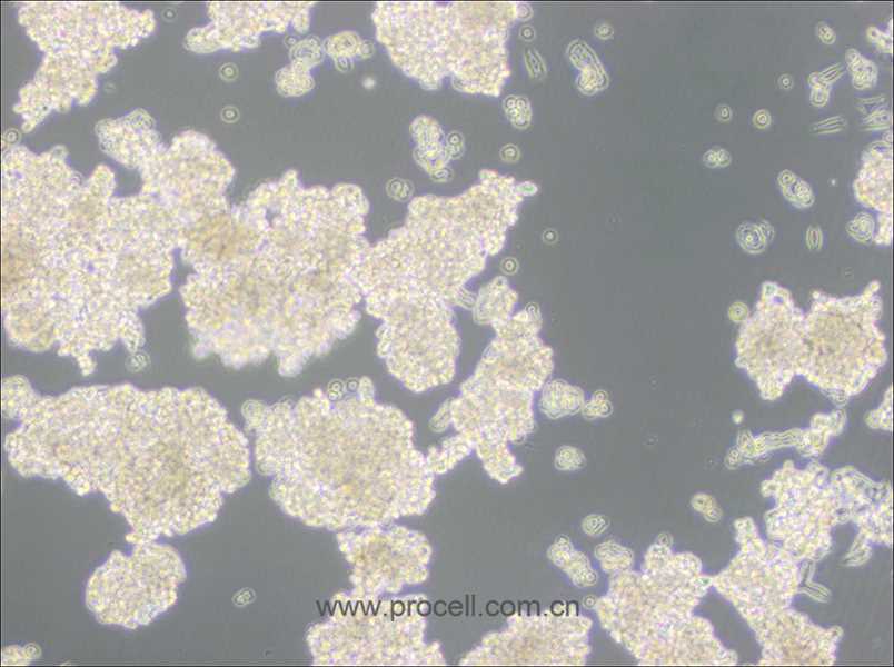 D341Med(人髓母细胞瘤细胞) (STR鉴定正确)