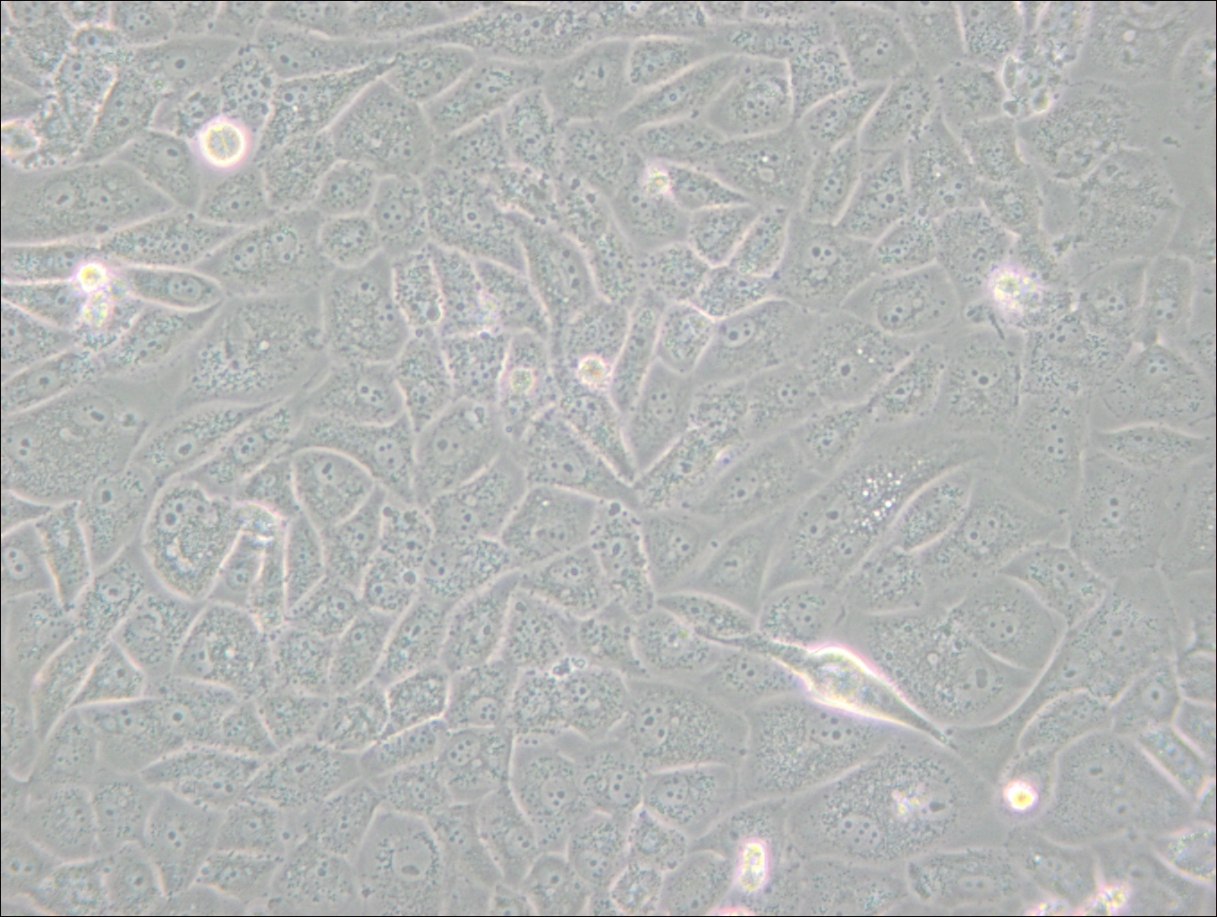 SK-LU-1 (人低分化肺腺癌细胞) (STR鉴定正确)