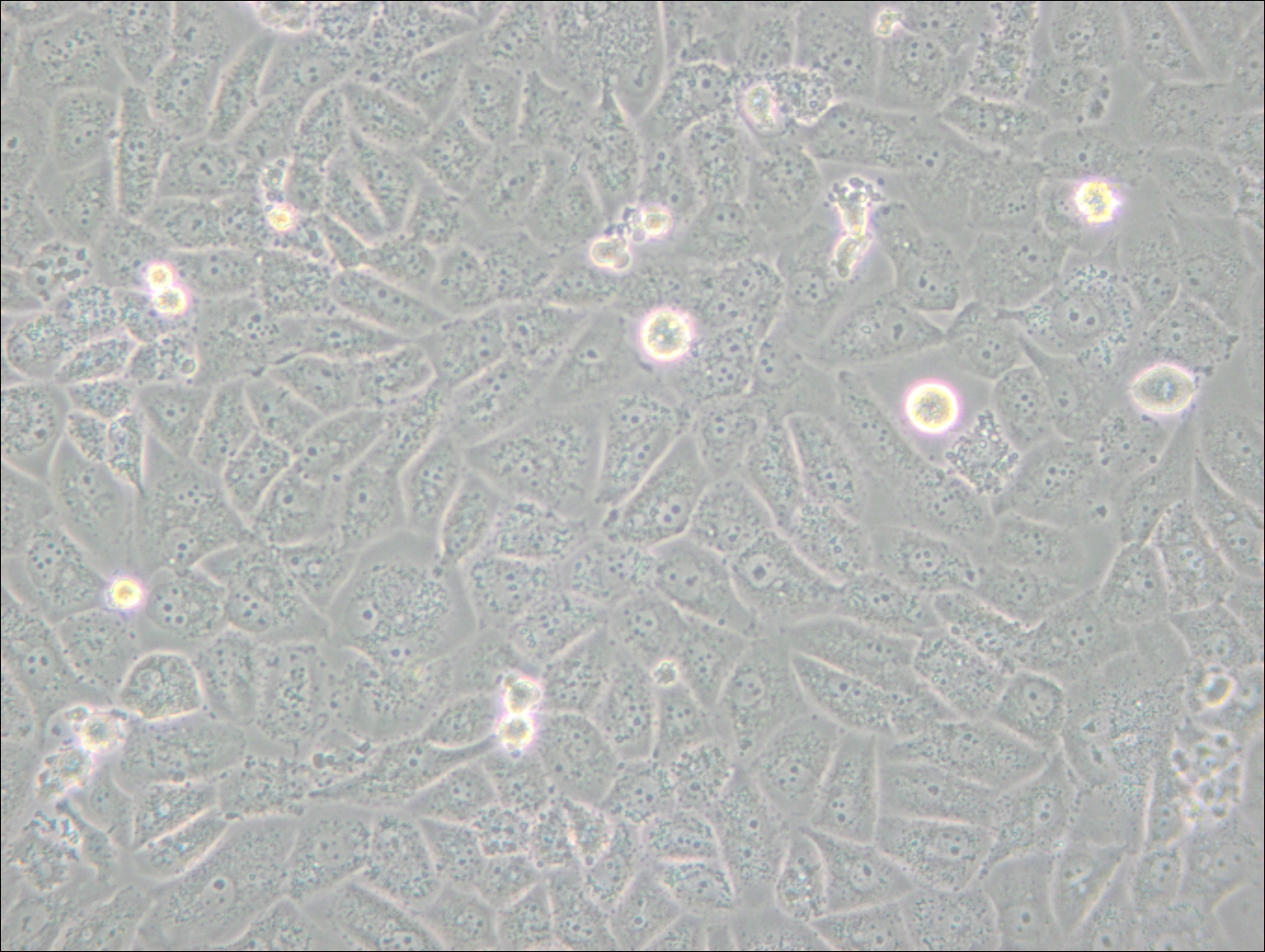 SK-LU-1 (人低分化肺腺癌细胞) (STR鉴定正确)