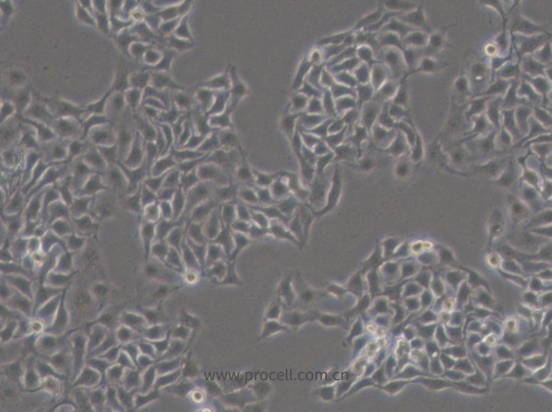 HCC1806 (人乳腺鳞状癌细胞) (STR鉴定正确)