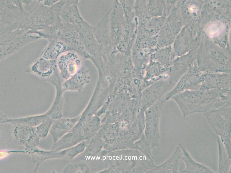 NCI-H196 (人小细胞肺癌细胞) (STR鉴定正确)