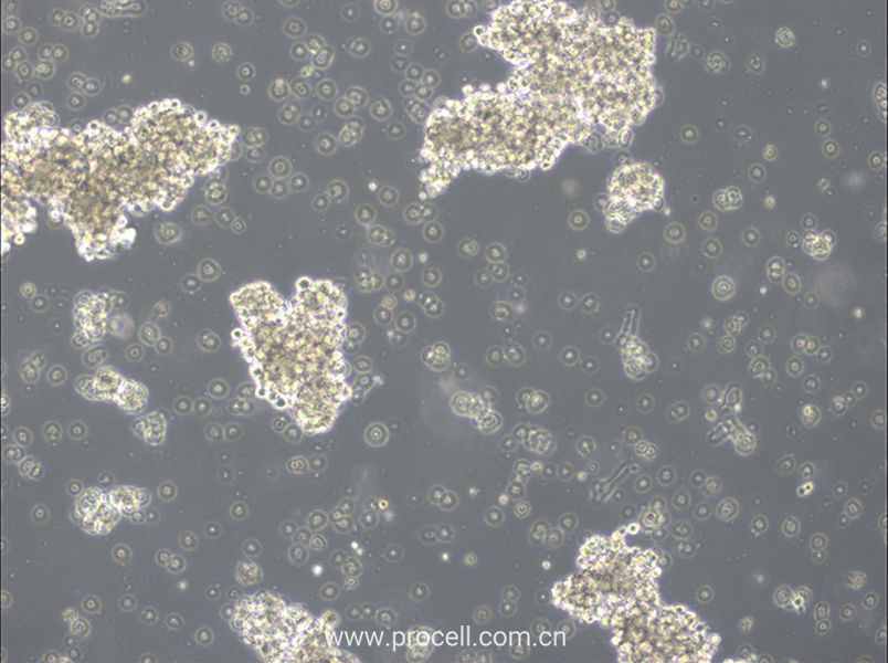 OCI-Ly3 (人弥漫大 B 细胞淋巴瘤细胞) (STR鉴定正确)